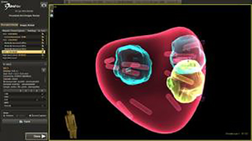 mr füzyon biyopsi üronav